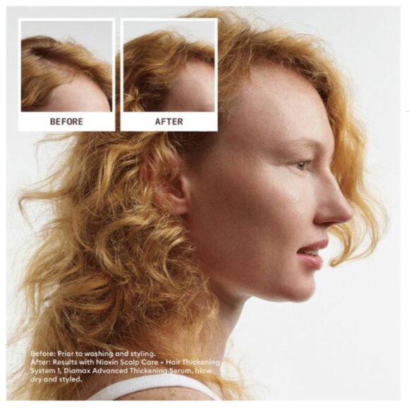 Nioxin System Trial Kit 1, Cleanser, Scalp Therapy, Scalp Treatment - Picture 3 of 3